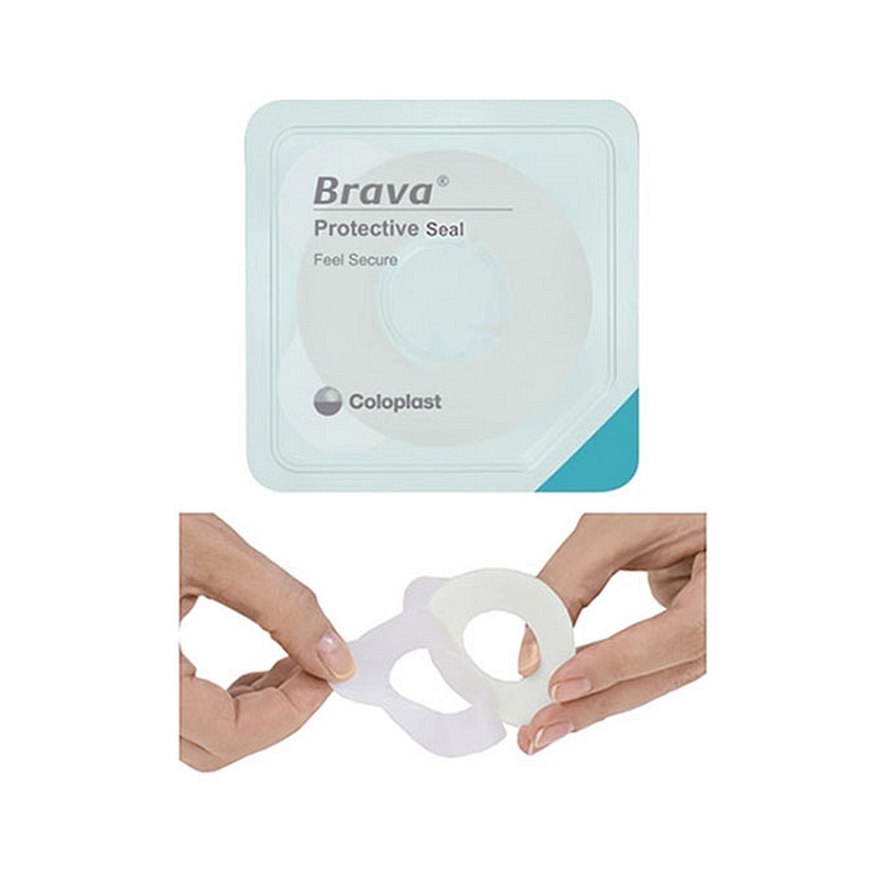 Moldable barrier ring designed to adhere securely and protect the skin around the stoma Soft