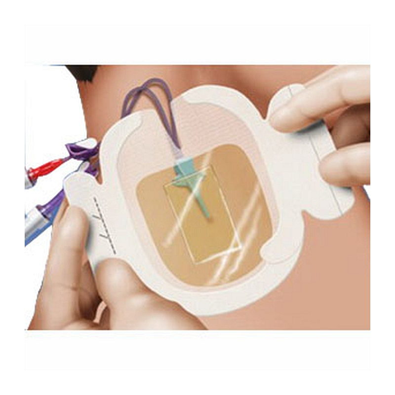 Tegaderm CHG Chlorhexidine Gluconate IV Securement Dressing