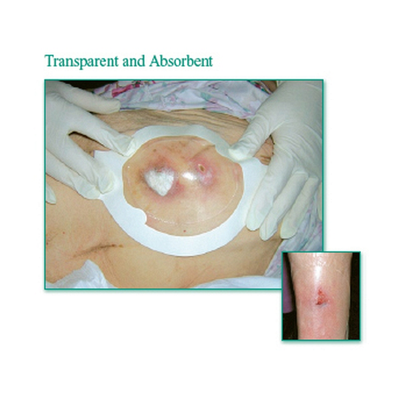 Tegaderm Clear Absorbent Acrylic Dressing 3" x 3-3/4" Oval