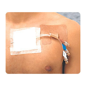 Cath-strip recloseable catheter fastener