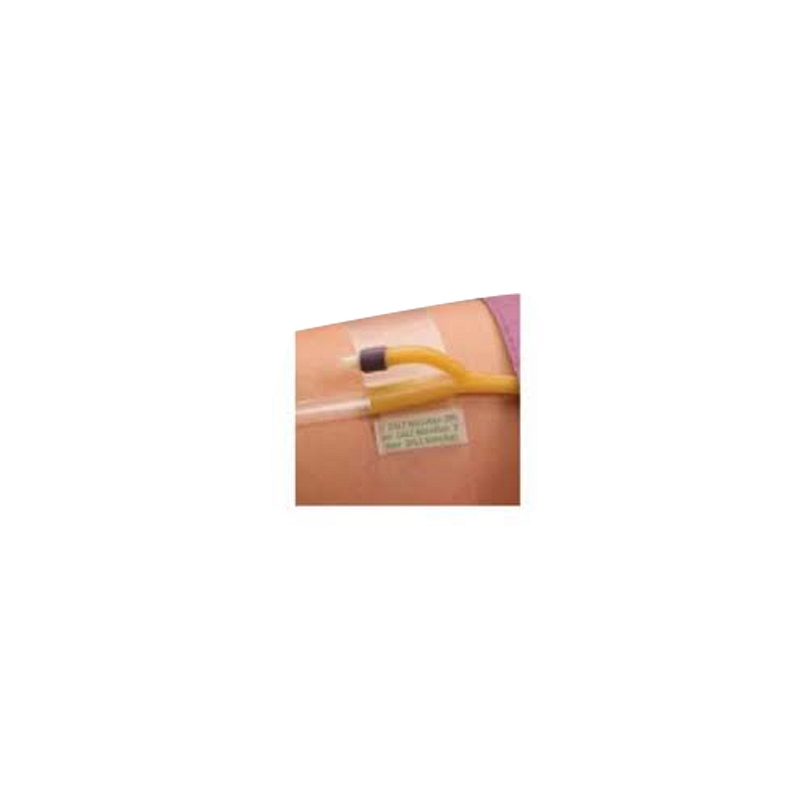 Hold-n-Place Foley Catheter Holder Adhesive Patch